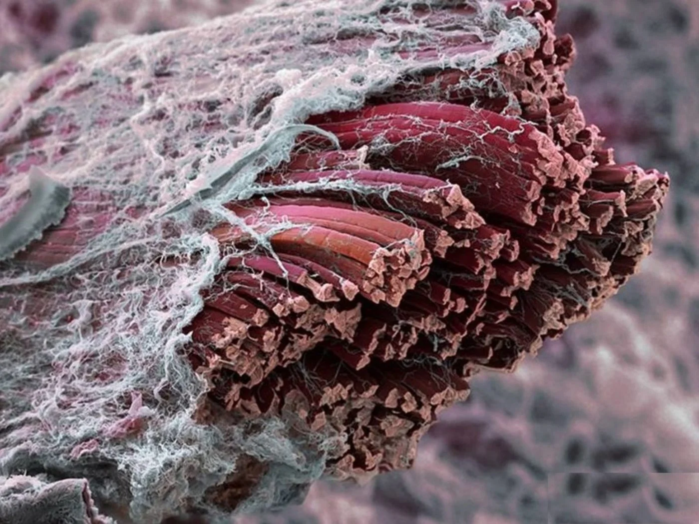 Magnified muscle and connective tissue, showing the web-like fascia surrounding muscle fibers