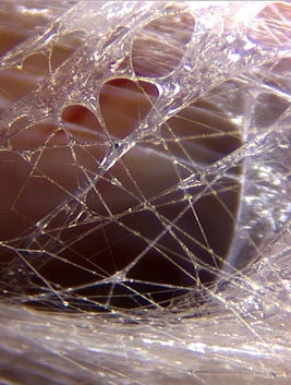 Magnified fascia showing the web-like connective tissue network