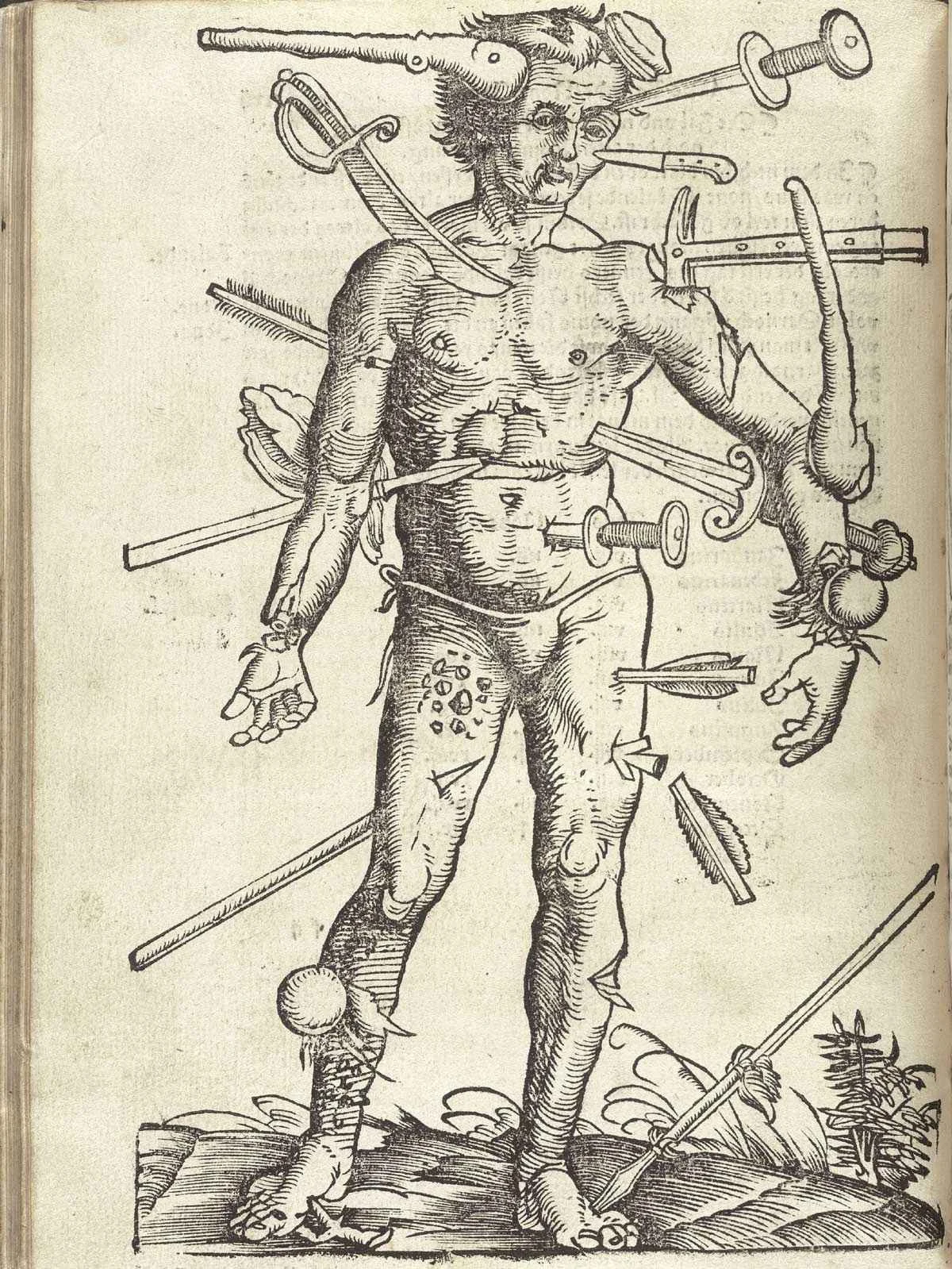 Historical illustration depicting chronic pain and injury